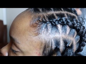 Stitch Braids For Beginners | How to Stitch Braids Using Rubber-bands
