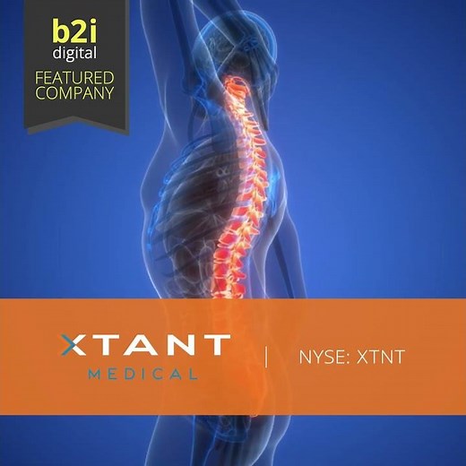 Xtant Medical Sells Coflex® Assets to Focus on Biologics