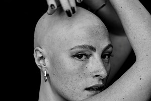 Model Amber Rowan wants to change the conversation about Alopecia