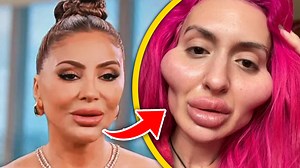 Top 10 Botched Plastic Surgery Fails That Ruined Celebrity Careers | Landonproduction