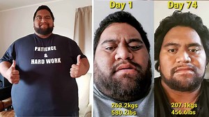Brave Man Embarks on a Lifesaving Weight Loss Journey
