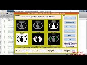 Lung Cancer Stage Detection Using Image Processing Matlab Source Code