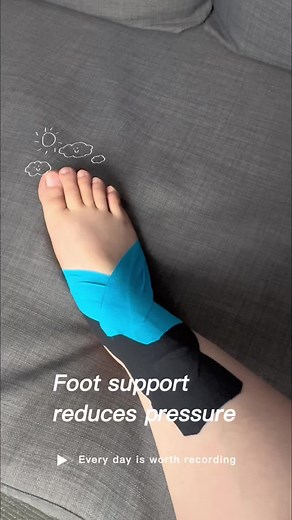 Kinesiology Tape Usage for Foot Support and Pain Relief