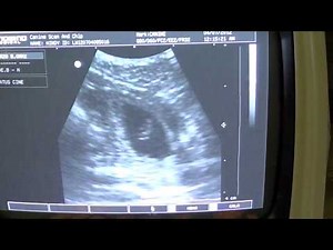 Dog Pregnancy Ultrasound Scan at 24 days post last mating by Canine Scan And Chip