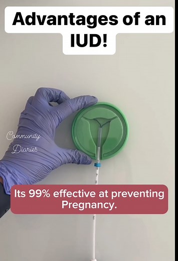 6.3K views · 27 reactions | Advantages of an IUD! #familyplanning #IUD #momtips #mommies #momlife #mom | Community Nurse | Facebook