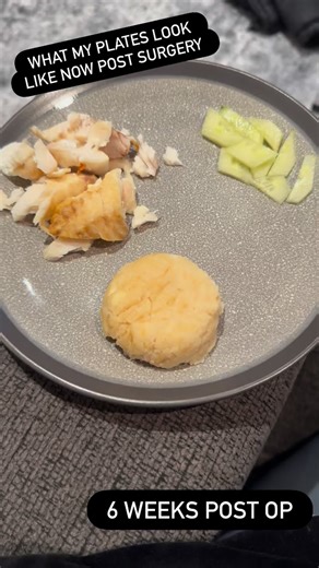 Meals after surgery - what you can expect from 6 weeks to 6 months post op #weightlossjourney #bariatricsurgery #plateingfood #protein #bariatriclife | Amanda Wolbaum