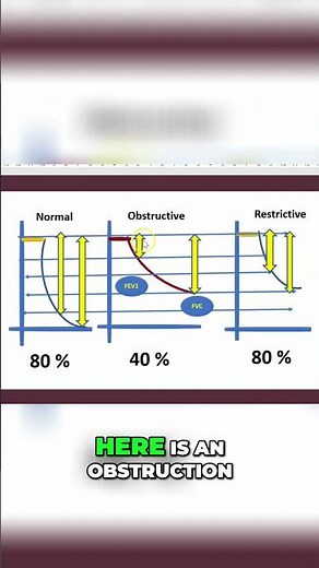 Spirometry FEV1/FVC: Airway Obstruction Explained