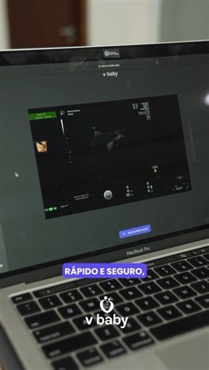 Tudo o que chega no Kit Boas-vindas do V-Baby, e como ele é simples de instalar! Em poucos minutos, sua clínica já está pronta para gravar ultrassons fetais, seja na versão IoT ou Desktop. Com instalação remota assistida, treinamento completo e até kit de divulgação para comunicar suas pacientes. Porque tecnologia boa é a que funciona sem complicar o dia a dia ✨ ▶️ Dá o play e confere como funciona. Tenha V-Baby em sua clínica: ( 55 11) 95320-3002 | Vlab
