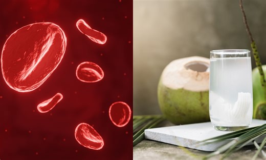 ¿El agua de coco puede ayudar a subir de manera natural las plaquetas?, le contamos