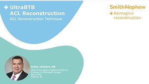 UltraBTB ACL Reconstruction Technique With Adjustable Button Fixation