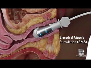 Empower RF by Inmode Modes of Action