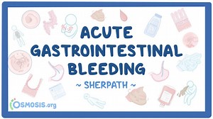 Critical care - Acute gastrointestinal bleeding: Nursing | Osmosis