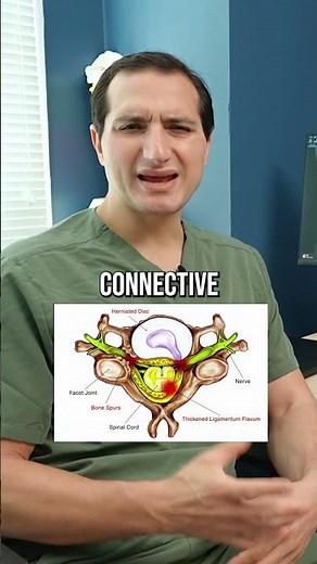 Most Common Symptom of Adult Degenerative Scoliosis