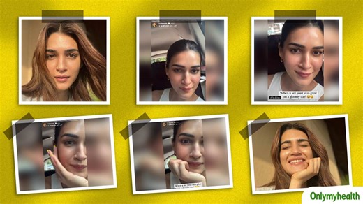 Kriti Sanon Shows Off Her Glowing Skin On A Gloomy Day, Know Her Skincare Routine