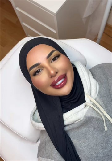 Velvet lips an meiner wunderschönen Freundin😍 Die Schwellung geht innerhalb von 1-2 Tagen zurück und das Ergebnis verblasst noch um 40% ab #permanentmakeup #pmu #velvetlips #viral #fy