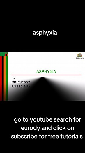 Understanding Neonatal Asphyxia: Causes and Care