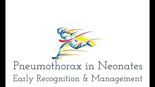 Pneumothorax Early Diagnosis and Management Radio-logical Diagnosis | Alok Sharma