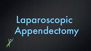 Appendix Removal Surgery, Darrin Hansen MD, Salt Lake City, Utah, Utah Lap Band https://www.youtube.com/watch?v=81Msr9RVO0A Laparoscopic removal of an appendix performed in 2012 by Dr. Darrin Hansen. DrDHansen.com Utahlapband.com | Clinical Anatomy & Operative Surgery