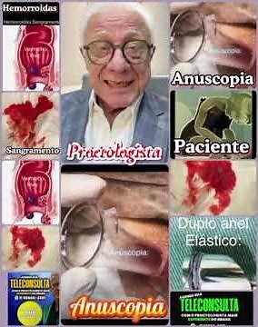 Médicos de plano de saúde não pedem a anuscopia te deixando sem diagnóstico! Ignoram o ESSENCIAL!