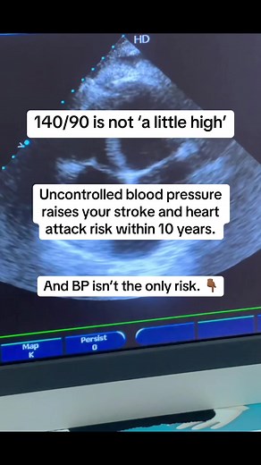Understanding Your 10-Year Cardiovascular Risk Due to Hypertension