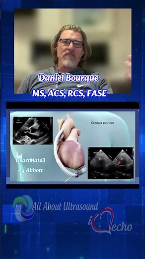 Advanced Cardiac Sonographer Mastery Course