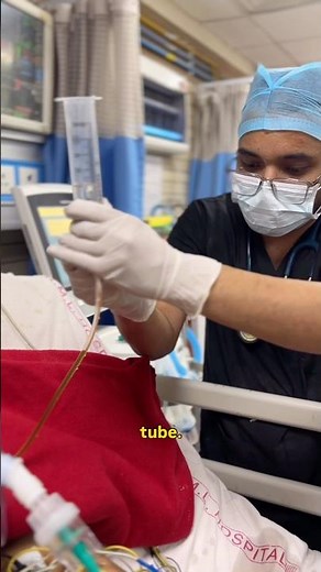 How to give Feeding in ICU ! #doctor #icu #meded