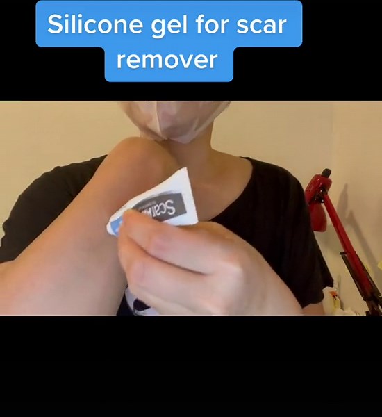 Using Scar Away Silicone Gel for Scar Removal
