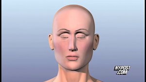 New Face for Chimp Attack Victim