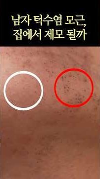 At-Home Laser Hair Removal for Men's Beards: My 3-Month Results