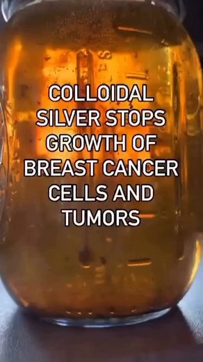 For the first time ever, colloidal silver has been shown to defeat cancer in an actual human trial! Yes, you read that right. Colloidal silver has now been observed by doctors to conquer cancer in a human. And get this: the colloidal silver was homemade! Colloidal silver and the sliver nanoparticles (SNPs) which make up colloidal silver have been increasingly shown to be effective against cancer cells and tumors in recent years. In fact, over 50 test tube and animal clinical studies have been co