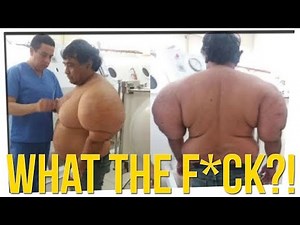 Diver's Body Ballooned After Accident ft. Steebee Weebee, Gina Darling & DavidSoComedy