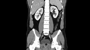 腹盆CT Radiology_ How to Read a CT Abdomen