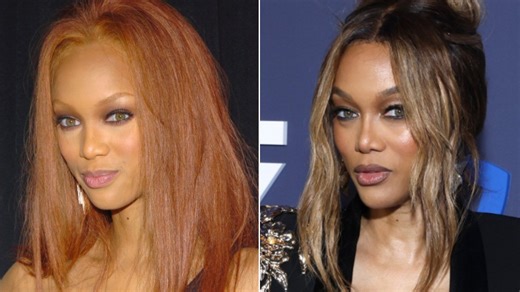 Side-by-side photos make Tyra Banks' face transformation hard to ignore