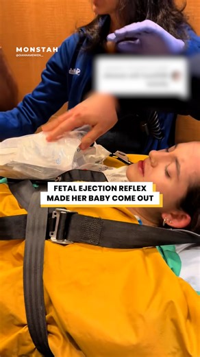 She couldn't stop giving birth 😱 | Monstah