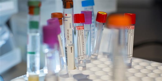 Side effects of immunotherapy treatment for cancer