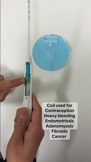 🤔 Thinking of the Coil? What to Expect During IUD Insertion (Quick Demo) #shorts