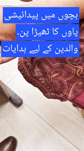 8K views · 125 reactions | Club foot #clubfootbaby #clubfootawareness #clubfootjourney #talipes | Dr. Arshad Mehmood - Child Specialist | Facebook