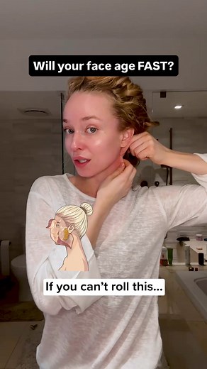 Understanding Facial Sagging: The Role of Tissue Mechanics