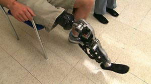 World’s First Bionic, Mind-Controlled Leg Allows Amputee to Go for a Walk
