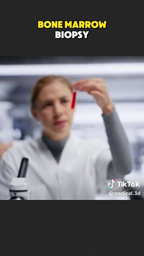 How Bone Marrow Biopsy Is Performed? (3D Animation) #bonemarrow #bonemarrowbiopsy #leukemia #anemia #bonemarrowfailure