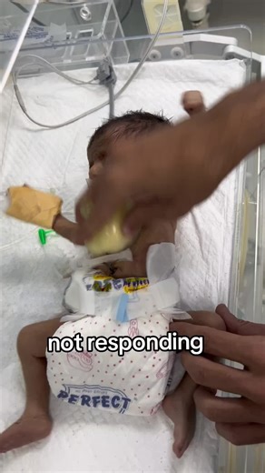 baby not responding #usa #newborn #usa #unfreezemyaccount | newborn baby
