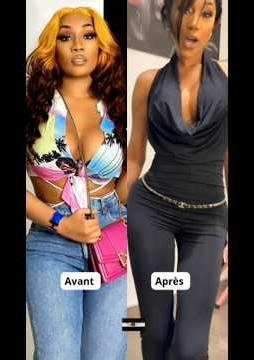 🔴 Avant et Après des Stars Ivoiriennes😱