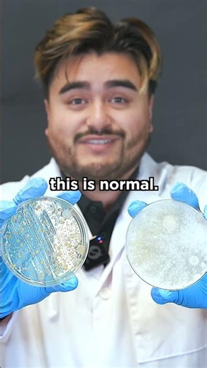 How Dirty is Your Light Switch? 💡🧫 #microbiology #staphylococcus