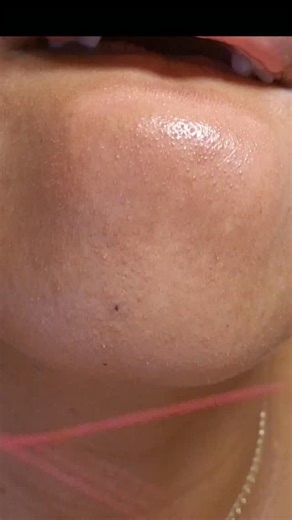 threads | Hair Removal thread is now available to purchase. Click on link #hairy #threading #pcos #threadinghairremoval #satisfying #hairremoval... | Instagram