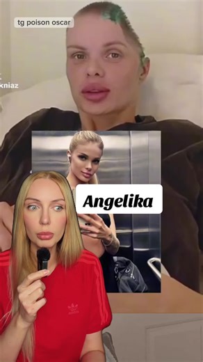 Lien vers la deuxième partie => @Hurrem Sultan tg: poison oscar Cette jeune femme a disparu après s’être disputée avec son ancien petit ami Dmitri, et a ensuite été retrouvée à l’hôpital #angelika #model #exboyfriend #europe #tiktoknews