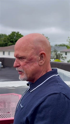 Realistic Prosthetic Ear Transformation with Magnetic Attachment – Alfredo’s Custom Silicone Ear