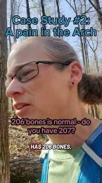 Case Study #2 The accessory navicular. An extra bone that can cause problems.