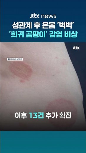 성관계 후 '희귀 곰팡이' 감염…미국서 확진 잇따라 '비상' #JTBC #Shorts