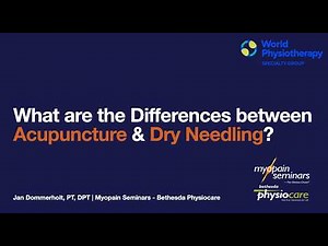 What are the Differences Between Acupuncture and Dry Needling?
