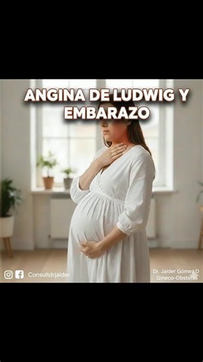 💥 Ludwig's angina is the clinical manifestation of choking or suffocation due to an inflammatory process in the face and neck, caused by an infectious cellulitis originating in the mandibular region that is not diagnosed in time and can compromise the lives of both the pregnant woman and her baby. 💥 This is a progressive syndrome (dental caries, dental abscess, osteomyelitis, cellulitis, and necrotizing fasciitis), with its main causes being the presence of abscessed cavities or trauma to the 